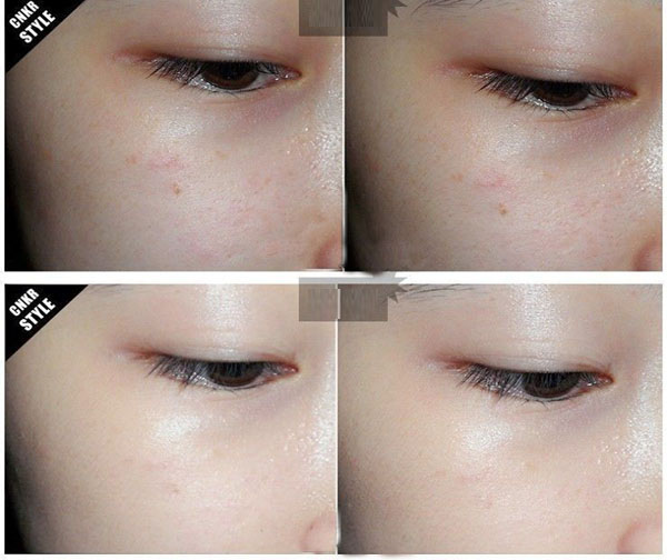 Sự khác nhau của BB, CC, DD, EE và PP Cream là gì? su-khac-nhau-cua-bb-cc-dd-ee-va-pp-cream-dd