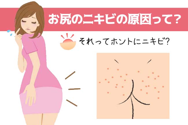 Kem hỗ trợ thâm mông Miwaku No Oshiri Nhật Bản Kem hỗ trợ thâm mông Miwaku No Oshiri Nhật Bản - Yêu Hàng Ngoại