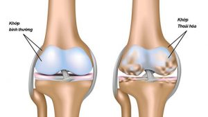 Công dụng của Glucosamine và Sụn vi cá mập trong điều trị xương khớp - Yêu Hàng Ngoại