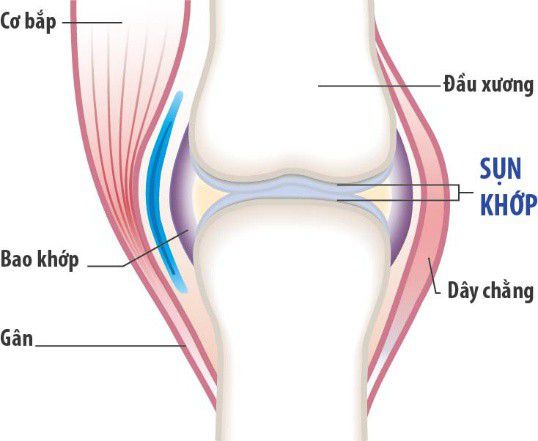 Công dụng của Glucosamine và Sụn vi cá mập trong điều trị xương khớp Công dụng của Glucosamine và Sụn vi cá mập trong điều trị xương khớp - Yêu Hàng Ngoại