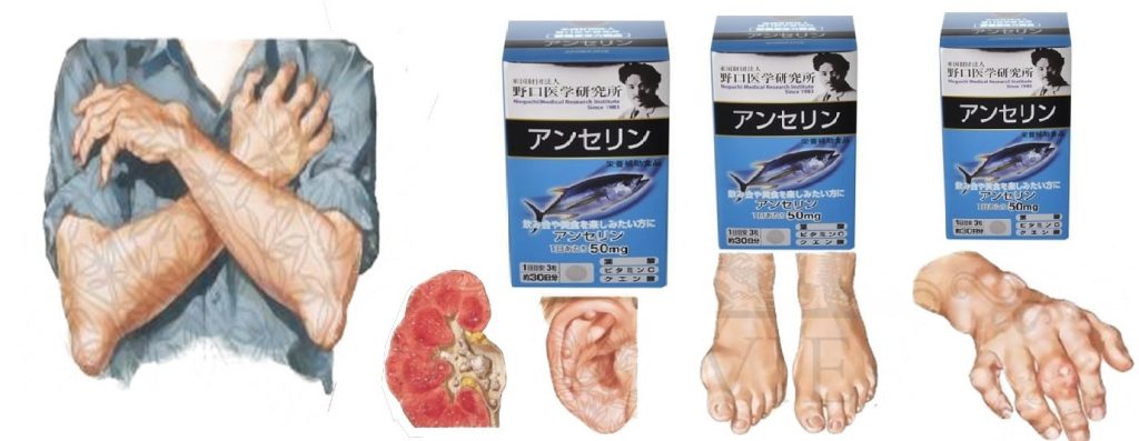 Viên uống hỗ trợ điều trị Gout Anserine Noguchi Nhật Bản Viên uống hỗ trợ điều trị Gout Anserine Noguchi Nhật Bản - Yêu Hàng Ngoại