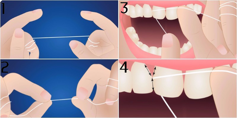 Những lỗi thường gặp khi chăm sóc răng miệng Những lỗi thường gặp khi chăm sóc răng miệng - Yêu Hàng Ngoại