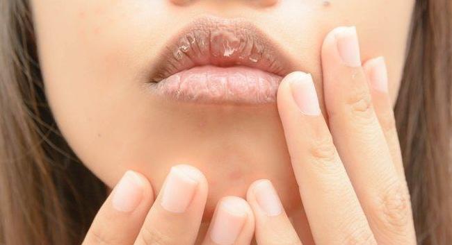 7 dấu hiệu cảnh báo làn da cần được chăm sóc 7 dấu hiệu cảnh báo làn da cần được chăm sóc - Yêu Hàng Ngoại