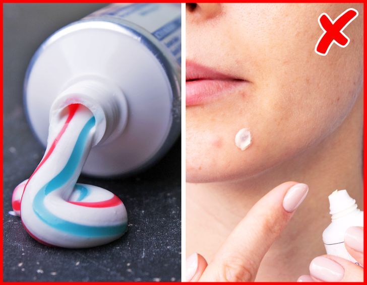 6+ nguyên nhân gây ra mụn mà bạn không ngờ tới 6+ nguyên nhân gây ra mụn mà bạn không ngờ tới - Yêu Hàng Ngoại