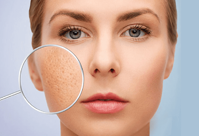 7+ dấu hiệu cảnh báo da lão hóa đối với phụ nữ sau tuổi 25 7+ dấu hiệu cảnh báo da lão hóa đối với phụ nữ sau tuổi 25 - Yêu Hàng Ngoại