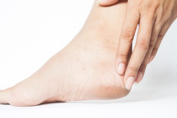 TOP những cách ngăn ngừa và cải thiện vết nứt nẻ gót chân vào mùa hè - Yêu Hàng Ngoại