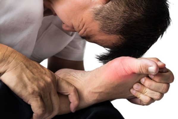 Điều gì sẽ xảy ra khi gout không được điều trị sớm - Yêu Hàng Ngoại