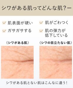 Kem dưỡng mắt Shiseido ELIXIR Retinol Power Wrinkle Smoothing Cream Nhật Bản Kem dưỡng mắt Shiseido ELIXIR Retinol Power Wrinkle Smoothing Cream Nhật Bản - Yêu Hàng Ngoại