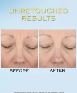 Tinh Chất Chống Nắng Lancôme UV Expert Supra Screen Serum SPF 50 Tinh Chất Chống Nắng Lancôme UV Expert Supra Screen Serum SPF 50 - Yêu Hàng Ngoại