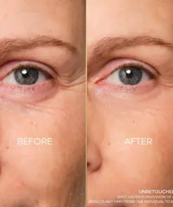Kem Dưỡng Mắt Guerlain Abeille Royale Eye Cream - Yêu Hàng Ngoại